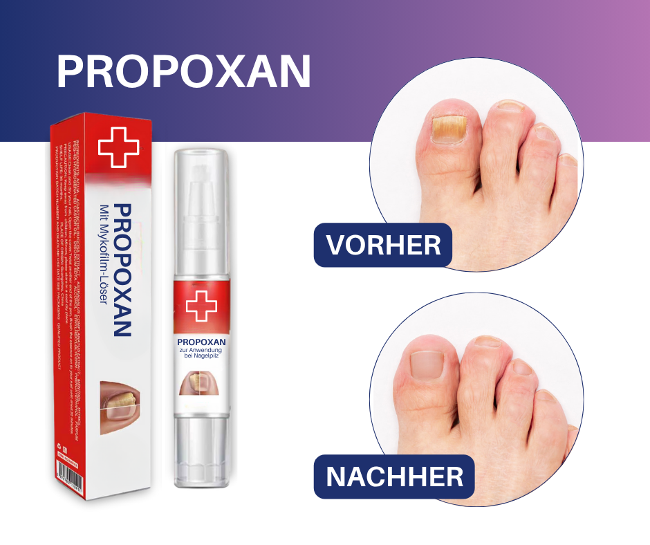 PROPOXAN - mit Mykofilm-Löser